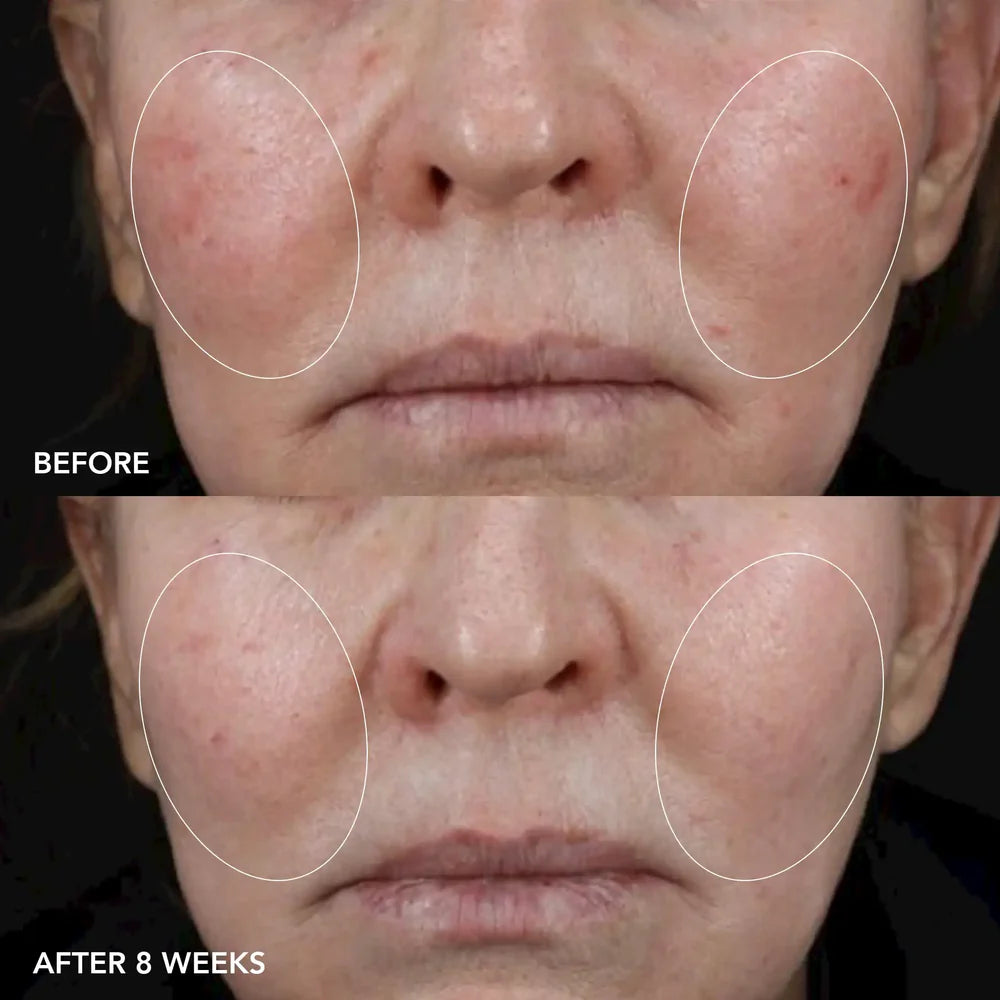 IMAGE MD® Bio Tech Longevity Cream
