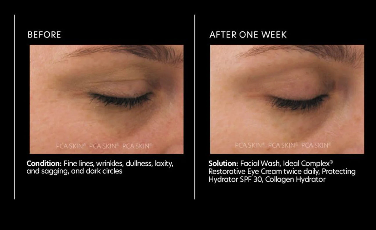 Ideal Complex® Restorative Eye Cream