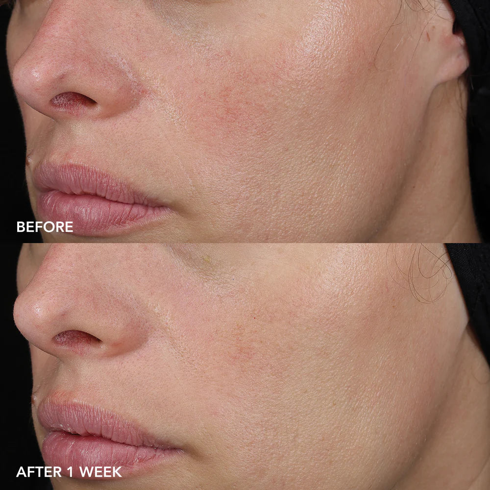 IMAGE MD® Barrier Repair Recovery Balm