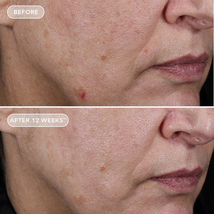 AGELESS+ retinol pure liquid retinol 0.75%