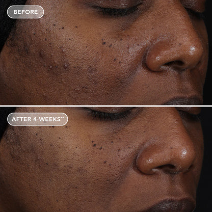 AGELESS+ retinol repair crème 0.3% retinol complex