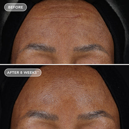 AGELESS+ retinol treatment crème 1.2% retinol complex