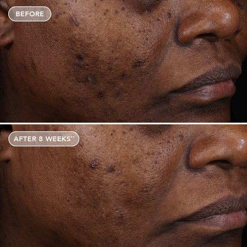 AGELESS+ retinol treatment crème 1.2% retinol complex