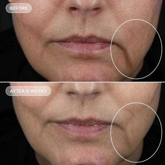 VOL.U.LIFT™ GLP-1 4D Skin Rebound Complex