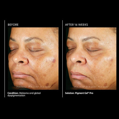 Pigment Gel® Pro