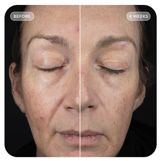 VOL.U.LIFT™ GLP-1 4D Skin Rebound Complex