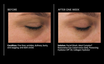 Ideal Complex® Restorative Eye Cream