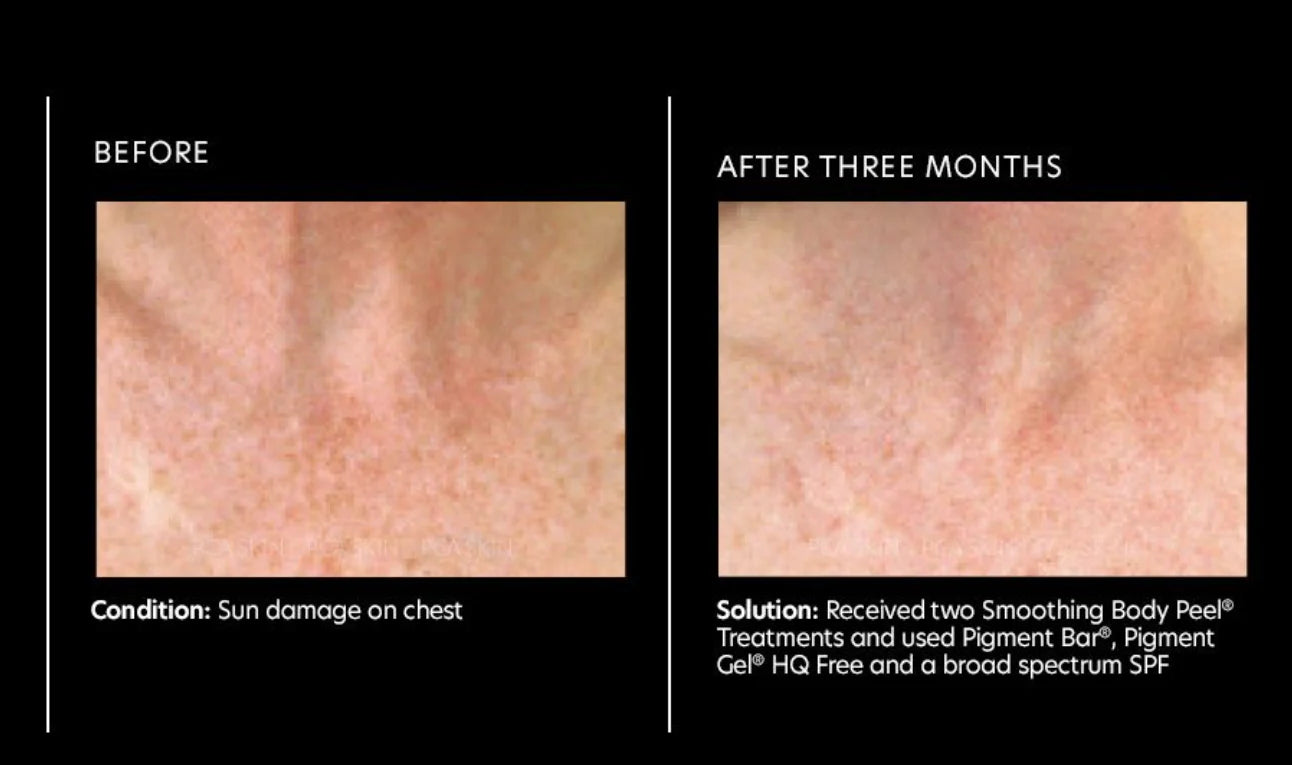 Pigment Bar®