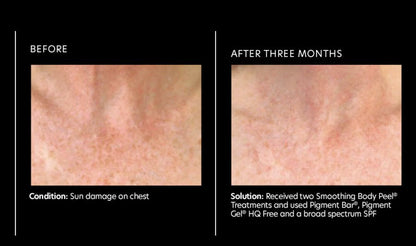 Pigment Bar®
